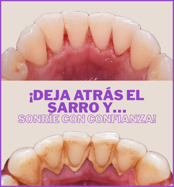 DENTAL FLOW IRRIGADOR BUCAL - Tecnología avanzada para una sonrisa saludable !